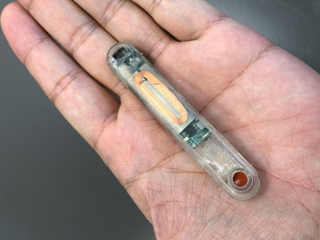 The implantable device setting in the palm of someone’s hand