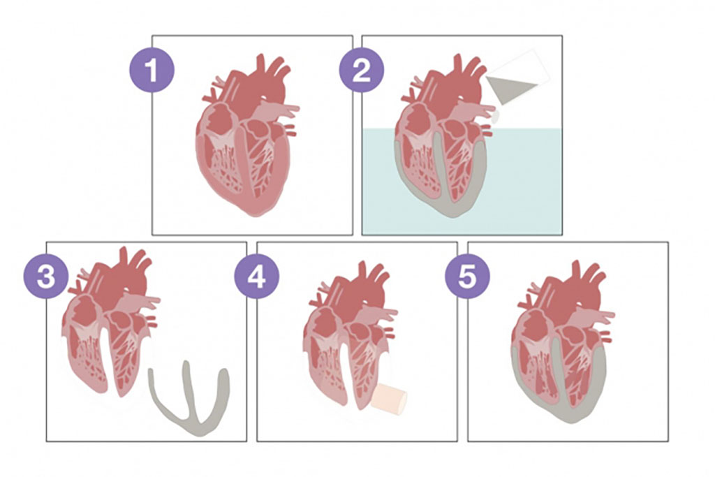 schematic of bionic heart