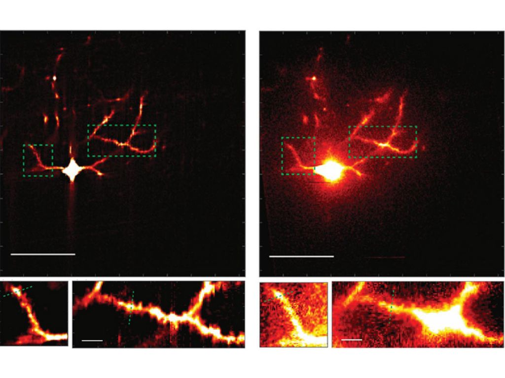 Four panels show a neuron glowing in red and yellow. The top left panel shows a neuron looing pretty sharp. Below that are zoomed in sections also looking detailed. On the right is a neuron that looks hazy. Below that are zoomed in sections that are also 