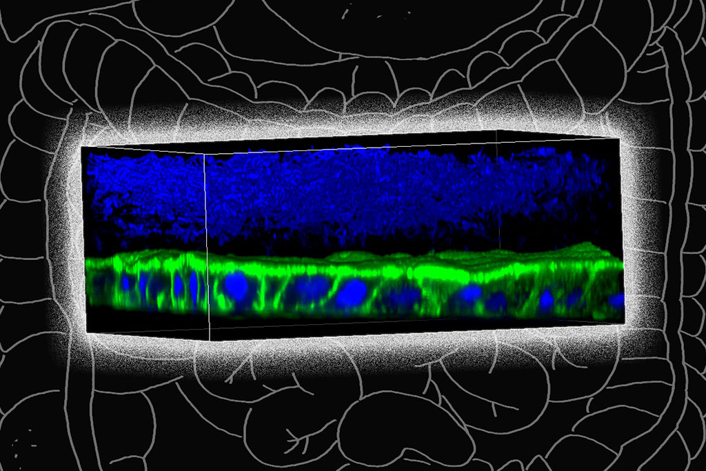 specialized device in which they can grow oxygen-intolerant bacteria in tissue that replicates the lining of the colon. F. prausnitzii bacteria (blue, at top of image) grow above a layer of human mucosal barrier cells (green and blue).