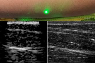 Researchers produce first laser ultrasound images of humans