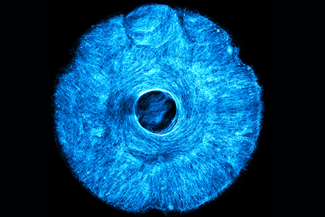 MIT engineers grew an artificial, muscle-powered structure that pulls both concentrically and radially.